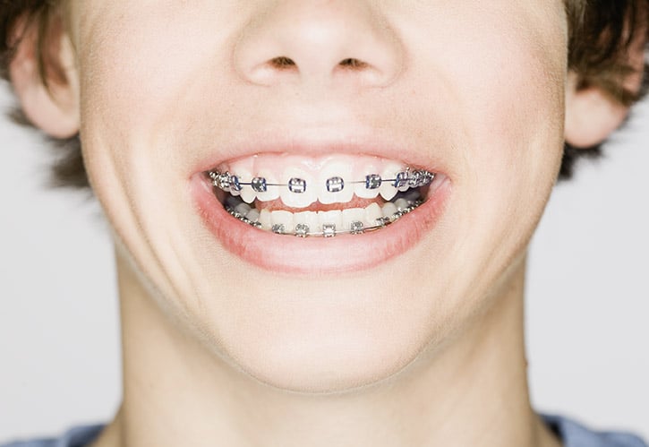 When should my child have an Orthodontic Evaluation?