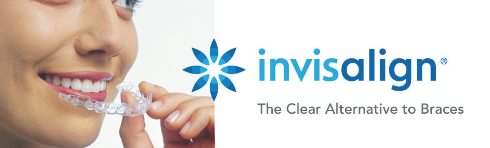 What is Invisalign and what are the benefits