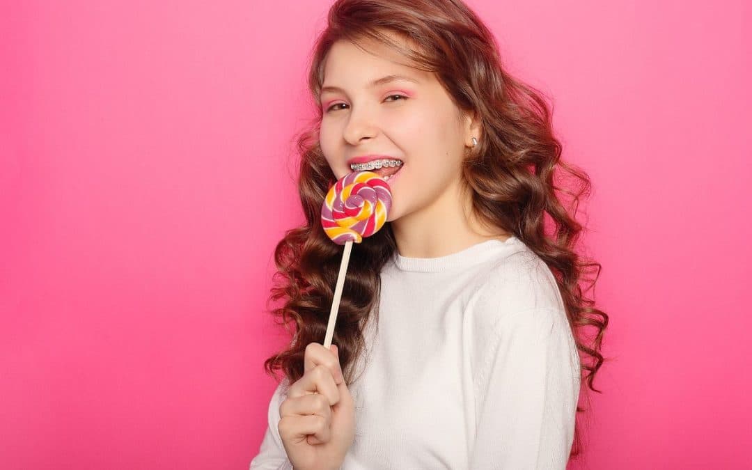 Best Candy Options for Braces