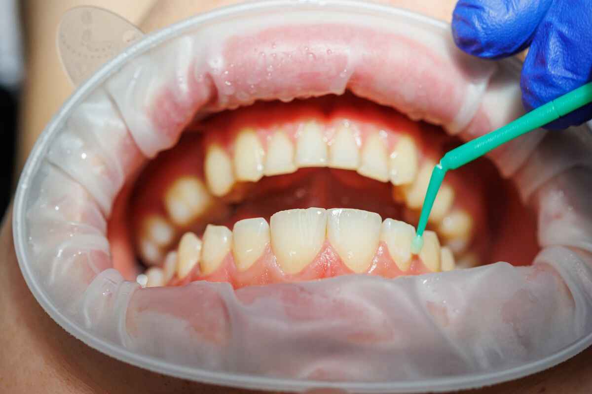 Dental cleaning procedure in clinic Dental cleaning procedure in clinic
