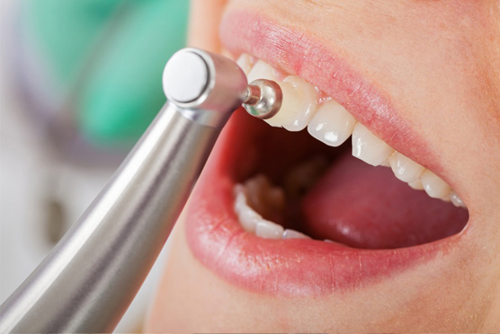 img-cosmetic-bonding