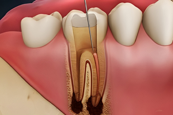 img-endodontics-riverside