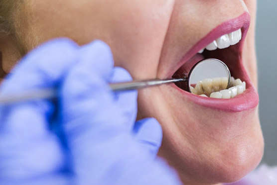 img-oral-surgery