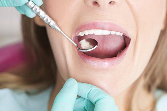 img-sedation-dentistry-galleria