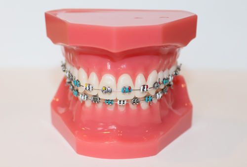 img-richmond-texas-orthodontics