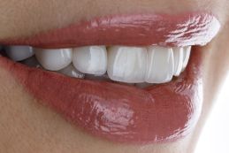 Dental Veneers Austin TX at BLVD Dentistry Dental Veneers Austin TX at BLVD Dentistry
