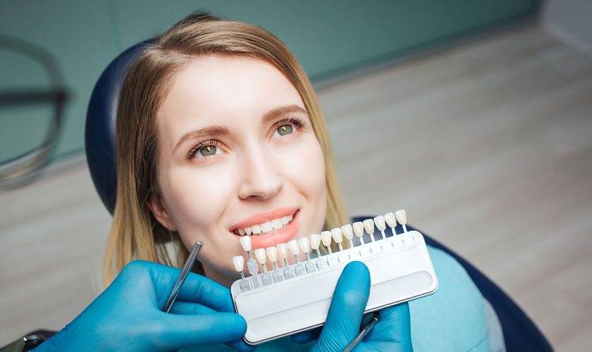 dental-veneers-houston dental veneers houston