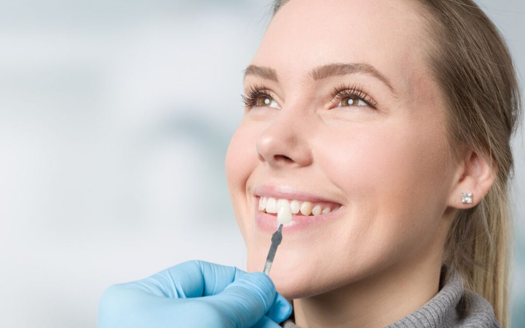 What is the Process for Getting Dental Veneers?