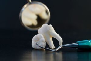 Wisdom Teeth and Orthodontics - BLVD Dentistry