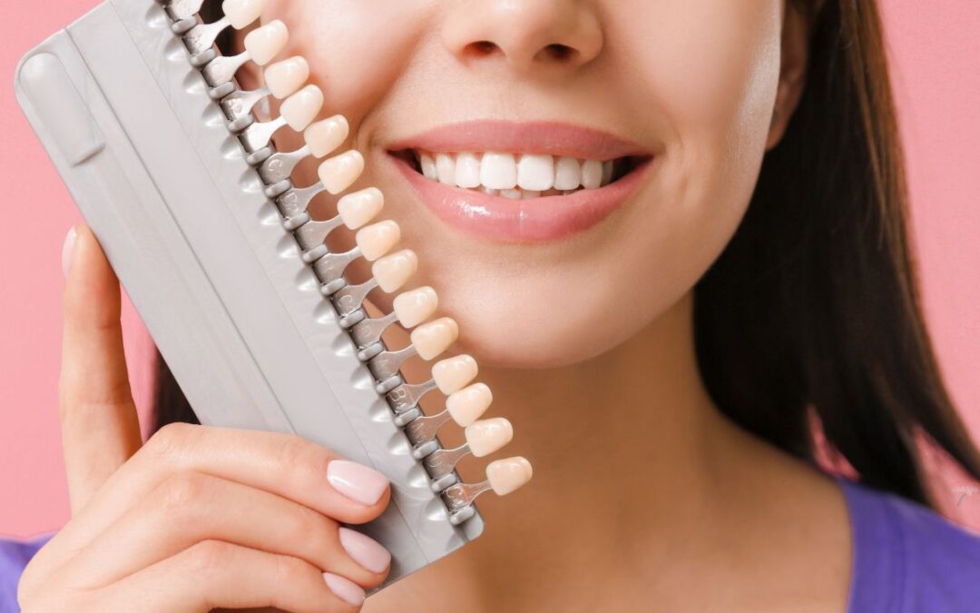 Can Veneers Fix Crooked Teeth