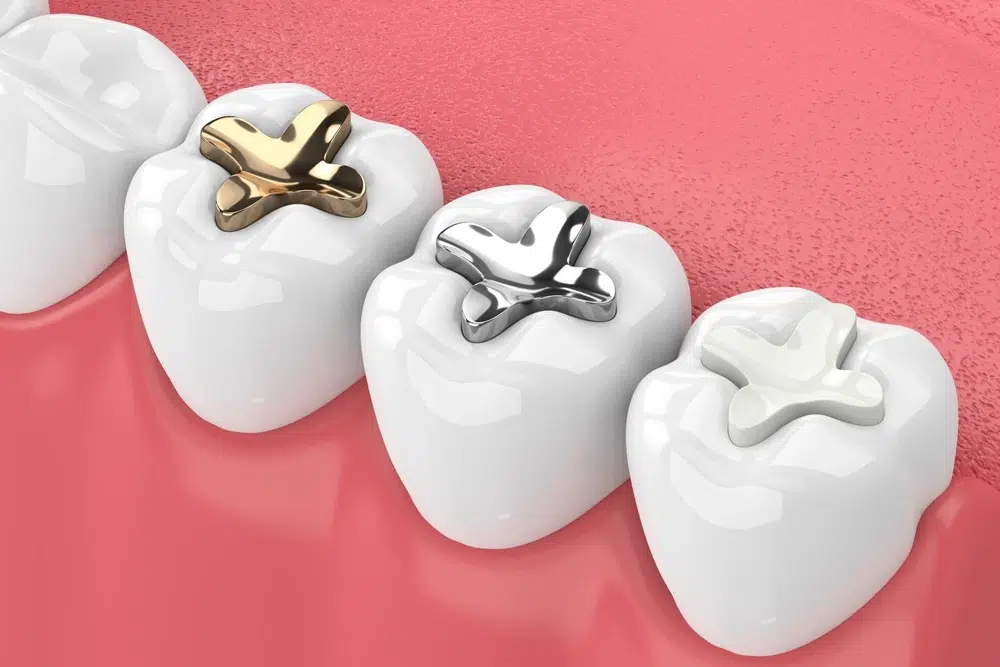 img-in-cypress-blvd-dentistry-orthodontics-provides