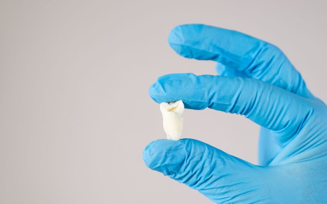 Is Tooth Extraction Safe for Heart Patients?