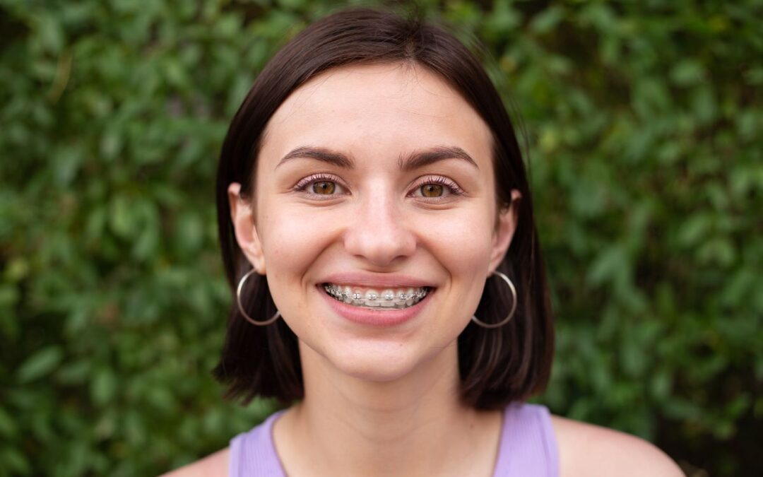 Can You Pause Your Orthodontic Treatment?