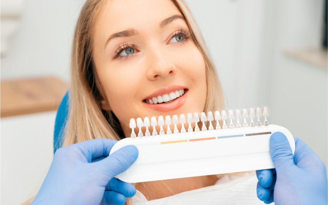 Keep Your Veneers Shining with These Simple Steps