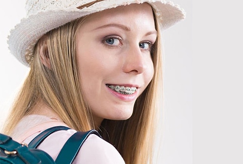 orthodontic treatment