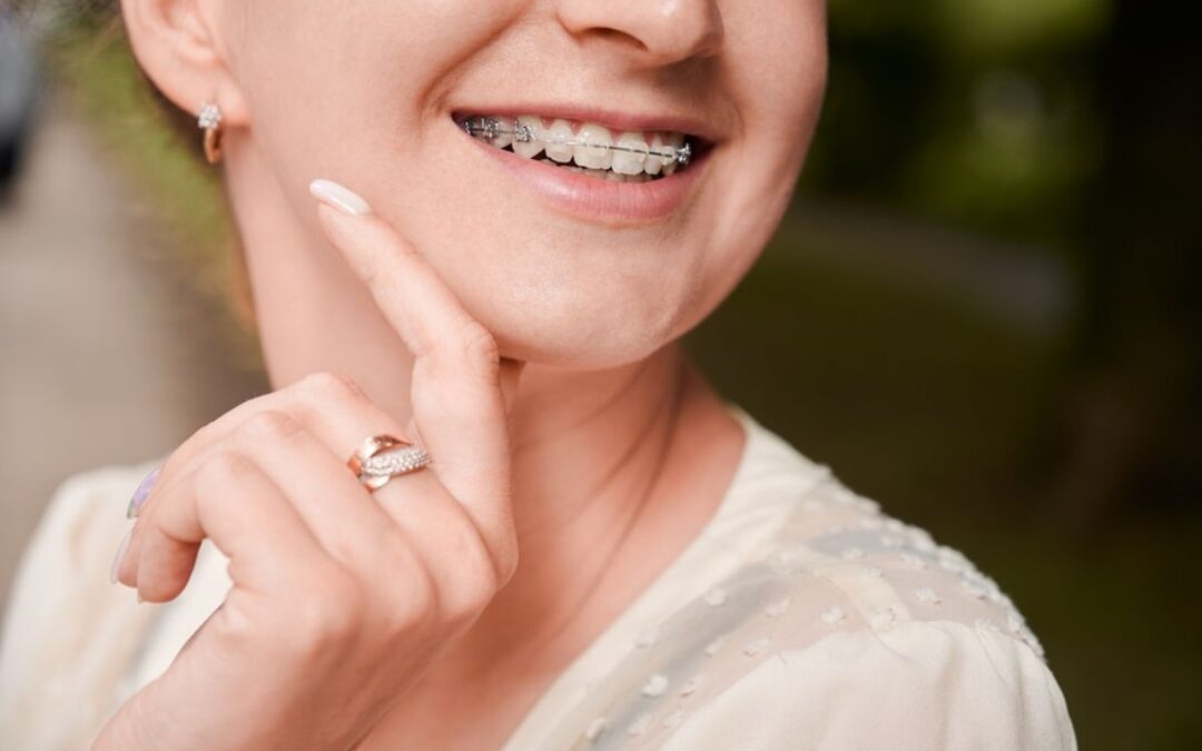 Selecting the Proper Orthodontic Specialist for Your Smile