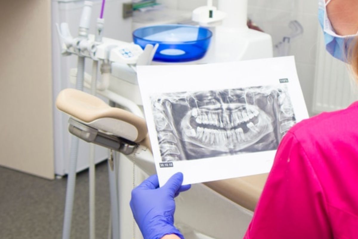 oral surgeon checking the x-ray of jaw structure
