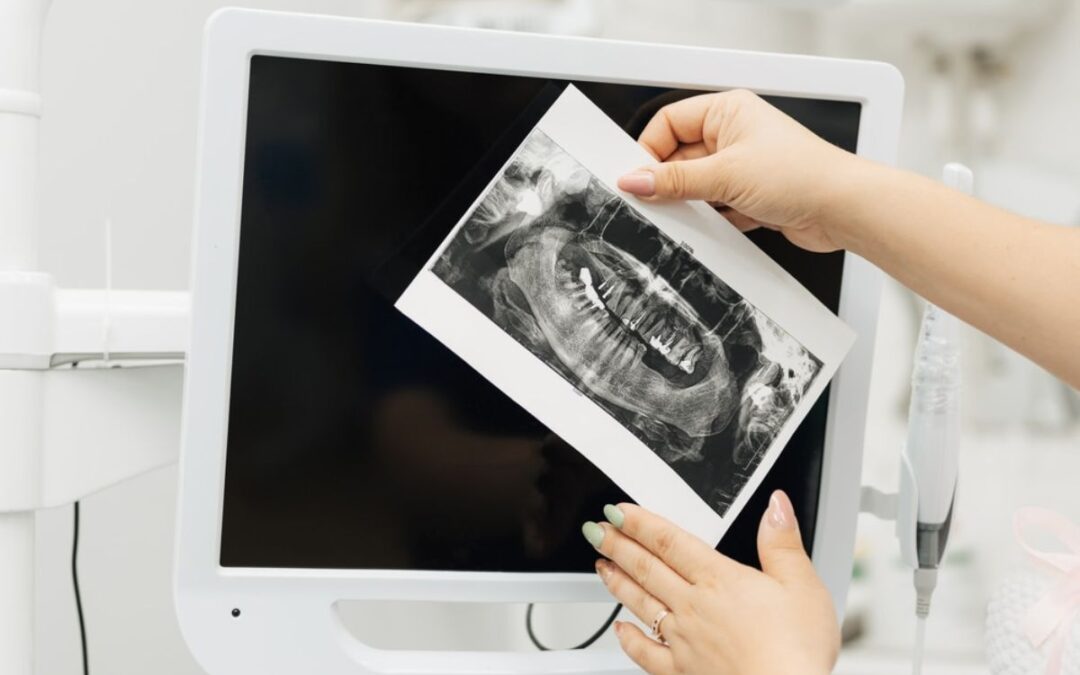 Why Every Dental Visit Could Save Your Life