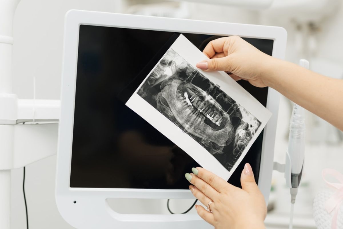 Early Oral Cancer Detection Starts at the Dentist in Houston TX at BLVD Dentistry & Orthodontics (1) Early Oral Cancer Detection Starts at the Dentist in Houston TX at BLVD Dentistry