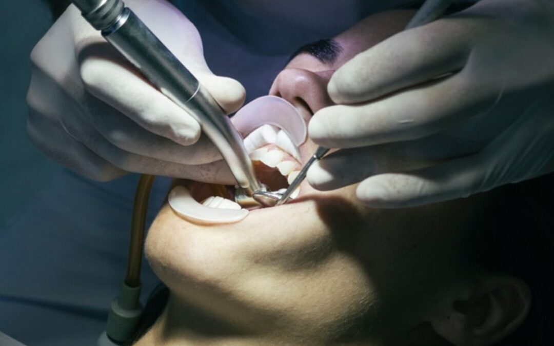 When to Get Your Teeth Cleaned