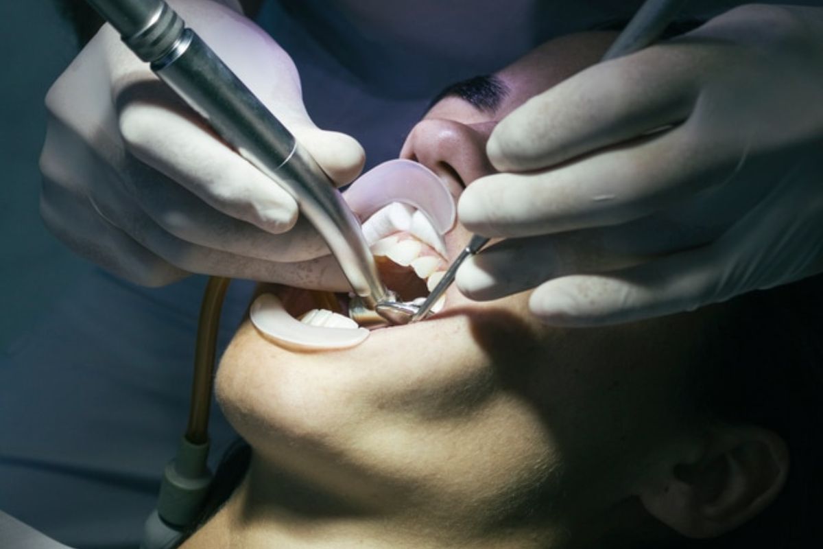 professional dental cleaning professional dental cleaning