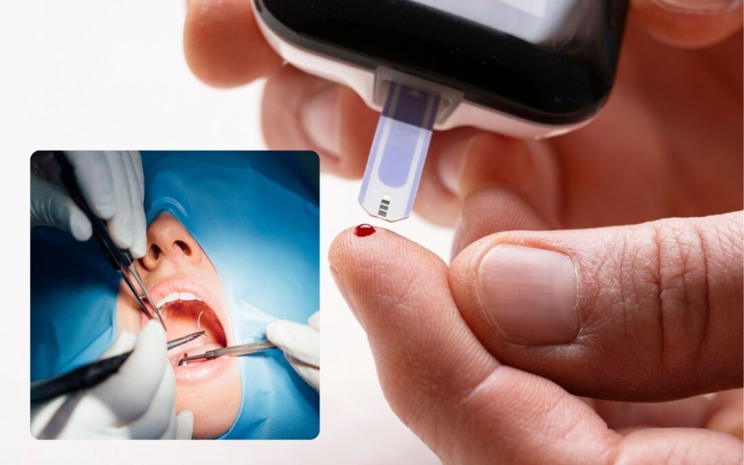 Can You Undergo Dental Surgery If Your Blood Sugar Is High?