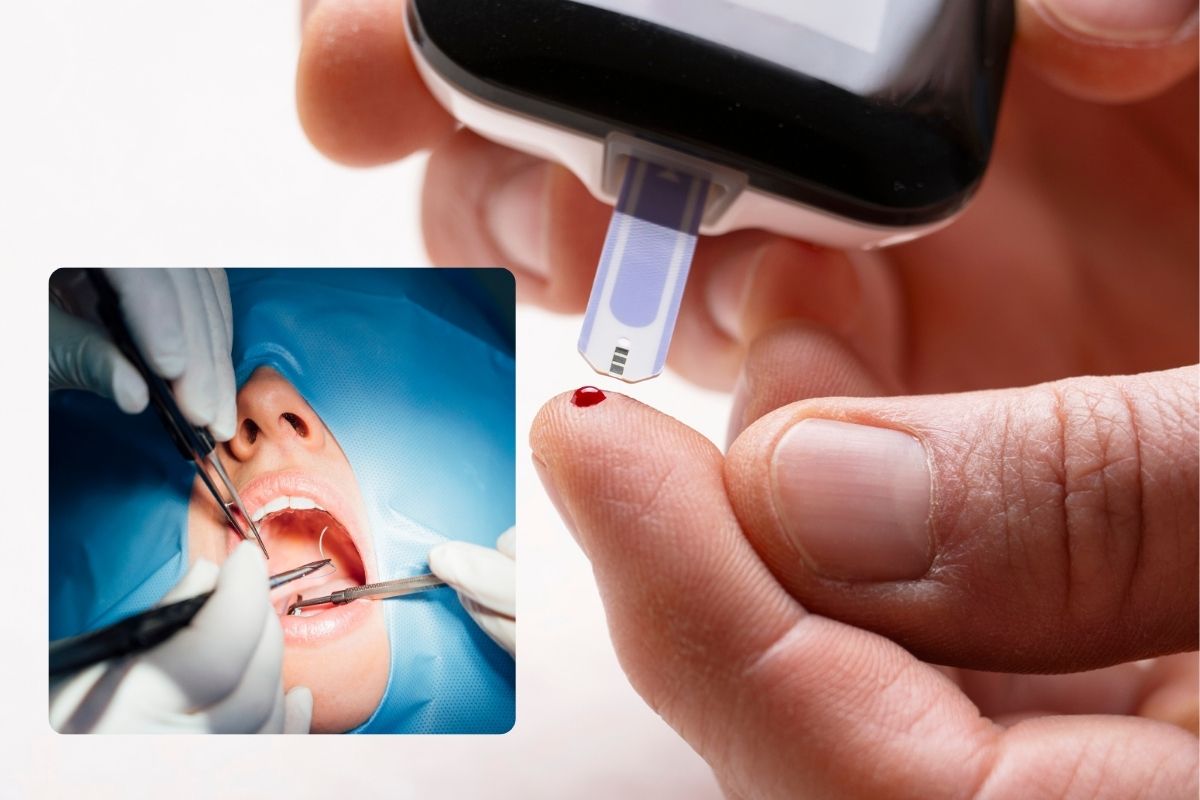 Dental Surgery If Your Blood Sugar Is High – BLVD Dentistry & Orthodontics – Houston, TX Dental Surgery If Your Blood Sugar Is High - BLVD Dentistry & Orthodontics - Houston, TX