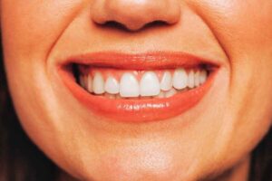 How Healthy Gums Look Like