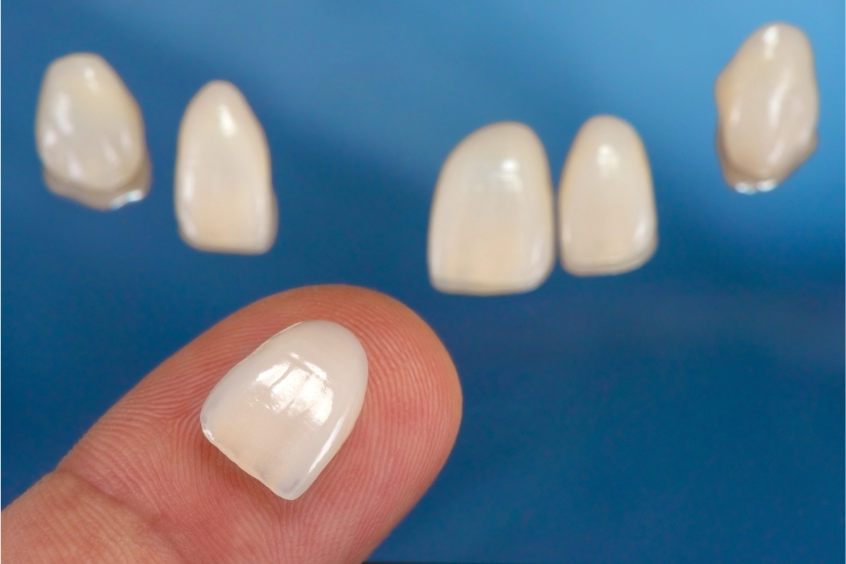 Small Adjustments, Big Smiles get dental veneers if you already have dental crown in Spring TX at BLVD Dentistry & Orthodontics