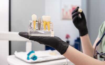 Dental Implants Houston: What to Ask Before Starting Treatment