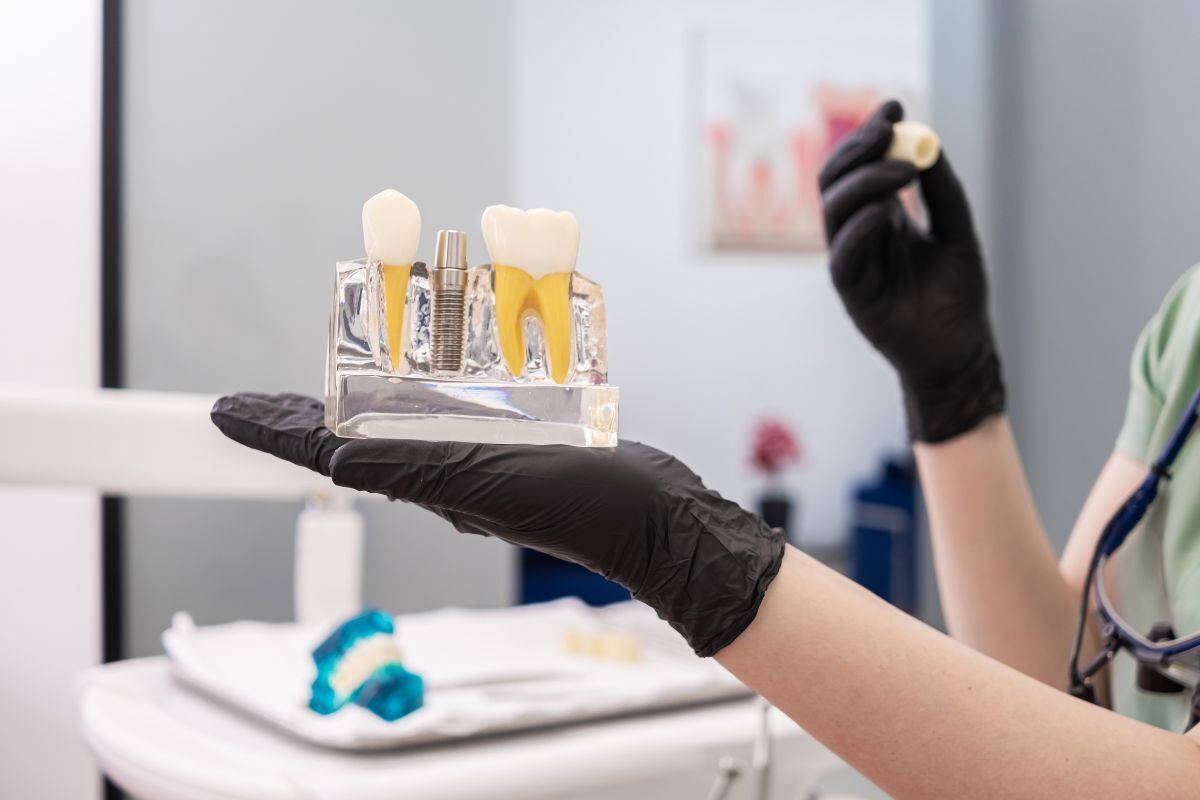 Dentist discussing dental implant treatment with Houston patient Dentist holding dental implant model showing tooth replacement and screw components.